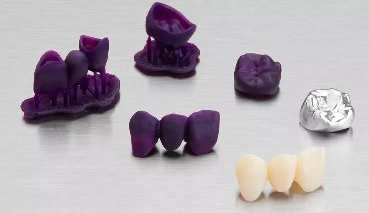 3D gedruckte Zahnkronen