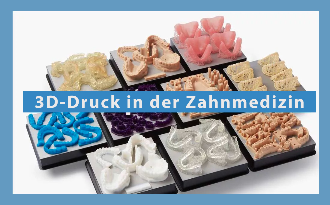 Der 3D-Druck in der Zahnheilkunde